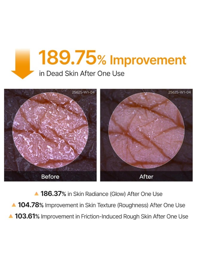 Dr.Melaxin Body Keratin Care Kojic Acid Turmeric Spray Gently Exfoliating Peeling Solution | 200ml - Image 5