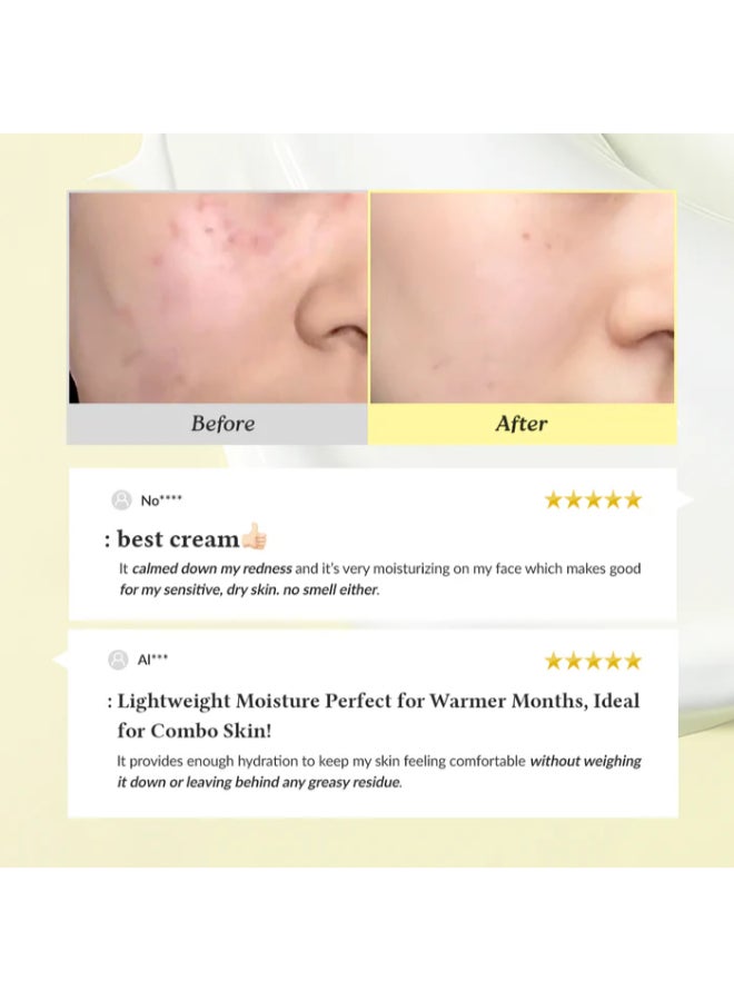 345 Relief Cream | Daily Face Moisturizer| Blemish Relief Care Soothing Recovery