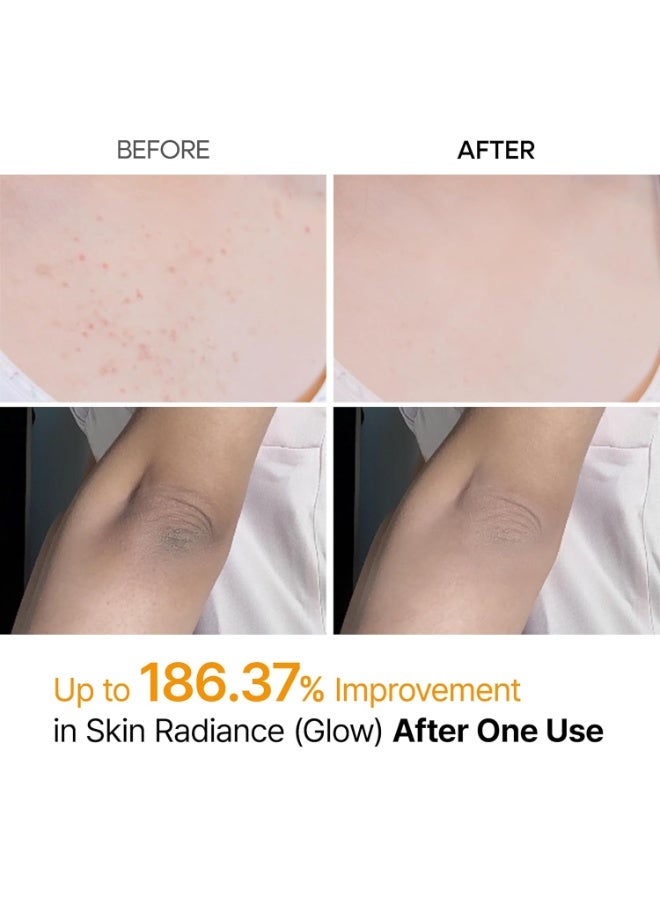 Dr.Melaxin Body Keratin Care Kojic Acid Turmeric Spray Gently Exfoliating Peelin