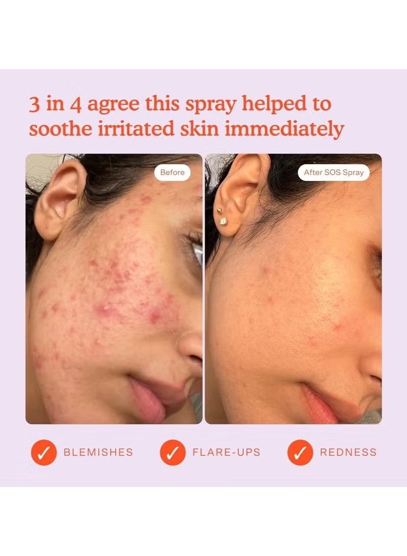 SOS Daily Rescue Facial Spray | Soothing and Refreshing pH Balancing Toner | Hyp