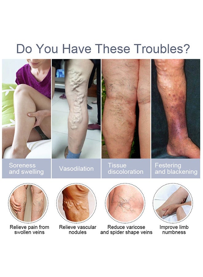 Varicose Veins Remove Cream 20g, Blood Circulation Vein Care Leg Cream, Vasculitis Phlebitis Foot Care Ointment, Pain Relief Therapy Firming Vein Lotion for Treatment of Varicose Veins - Image 2
