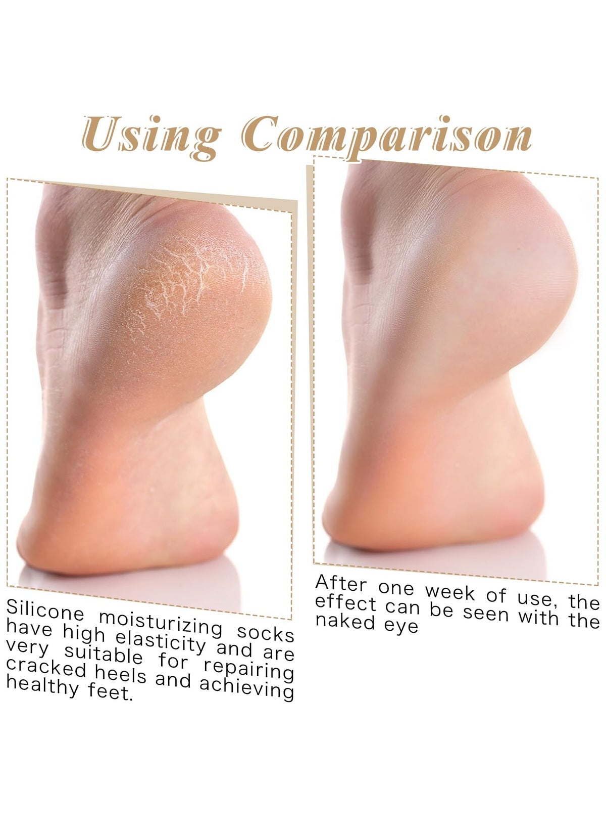 4 pairs moisturizing heel socks for dry cracked heels, cracked heel treatment repair socks - Image 4