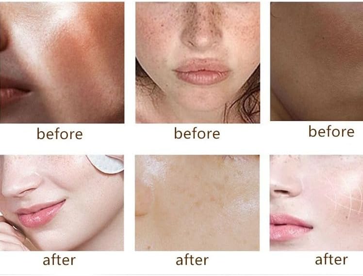 SADOER Vitamin C Brightening Essence Serum, Fresh Orange Extract, Moisturising Face Treatment, 30ml - Image 3